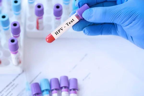 Affordable STD Testing Services in Plymouth